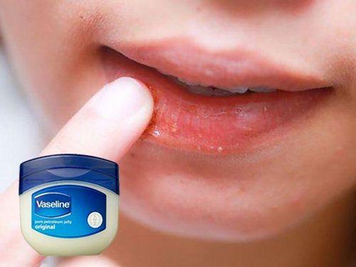 Bôi Vaseline lên môi có thể giúp bảo vệ vùng đôi môi bị khô và nứt nẻ khi thời tiết trở lạnh